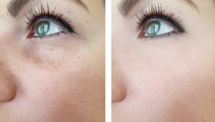 EELHOE Eye Firming & Lifting Cream